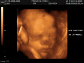 baby2007/2008-01-17_sonogram/BABY_11.JPG