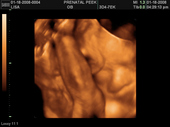 baby2007/2008-01-17_sonogram/BABY_12.JPG