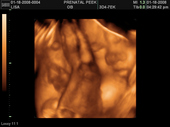 baby2007/2008-01-17_sonogram/BABY_14.JPG