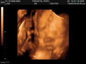 baby2007/2008-01-17_sonogram/BABY_19.JPG