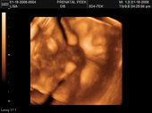 baby2007/2008-01-17_sonogram/BABY_2.JPG