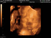 baby2007/2008-01-17_sonogram/BABY_20.JPG