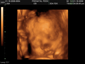 baby2007/2008-01-17_sonogram/BABY_21.JPG