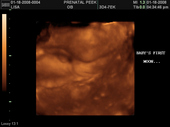 baby2007/2008-01-17_sonogram/BABY_23.JPG