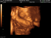 baby2007/2008-01-17_sonogram/BABY_27.JPG