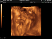 baby2007/2008-01-17_sonogram/BABY_28.JPG