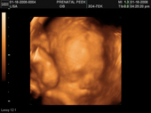 baby2007/2008-01-17_sonogram/BABY_3.JPG