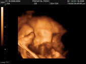baby2007/2008-01-17_sonogram/BABY_35.JPG