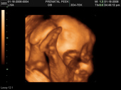 baby2007/2008-01-17_sonogram/BABY_37.JPG