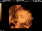 baby2007/2008-01-17_sonogram/BABY_38.JPG