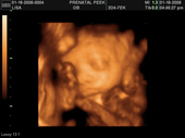 baby2007/2008-01-17_sonogram/BABY_39.JPG