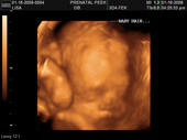 baby2007/2008-01-17_sonogram/BABY_4.JPG