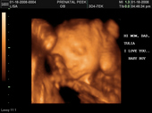 baby2007/2008-01-17_sonogram/BABY_43.JPG