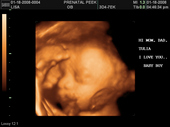 baby2007/2008-01-17_sonogram/BABY_44.JPG