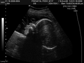 baby2007/2008-01-17_sonogram/BABY_46.JPG
