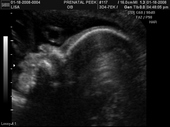 baby2007/2008-01-17_sonogram/BABY_47.JPG