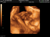 baby2007/2008-01-17_sonogram/BABY_48.JPG