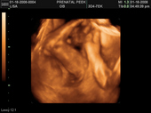 baby2007/2008-01-17_sonogram/BABY_49.JPG