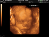 baby2007/2008-01-17_sonogram/BABY_5.JPG