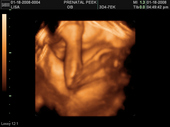 baby2007/2008-01-17_sonogram/BABY_50.JPG