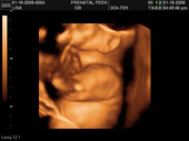baby2007/2008-01-17_sonogram/BABY_51.JPG