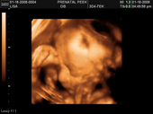 baby2007/2008-01-17_sonogram/BABY_53.JPG