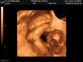 baby2007/2008-01-17_sonogram/BABY_54.JPG