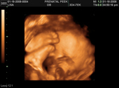 baby2007/2008-01-17_sonogram/BABY_55.JPG