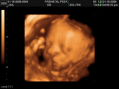 baby2007/2008-01-17_sonogram/BABY_56.JPG