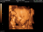 baby2007/2008-01-17_sonogram/BABY_57.JPG