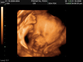 baby2007/2008-01-17_sonogram/BABY_58.JPG