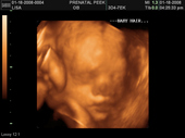baby2007/2008-01-17_sonogram/BABY_6.JPG