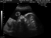 baby2007/2008-01-17_sonogram/BABY_61.JPG