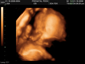 baby2007/2008-01-17_sonogram/BABY_66.JPG