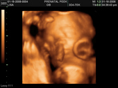 baby2007/2008-01-17_sonogram/BABY_69.JPG