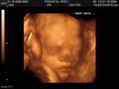 baby2007/2008-01-17_sonogram/BABY_7.JPG