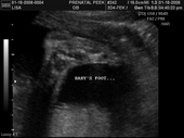 baby2007/2008-01-17_sonogram/BABY_70.JPG
