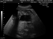 baby2007/2008-01-17_sonogram/BABY_71.JPG