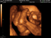 baby2007/2008-01-17_sonogram/BABY_74.JPG