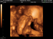 baby2007/2008-01-17_sonogram/BABY_76.JPG