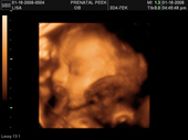 baby2007/2008-01-17_sonogram/BABY_79.JPG