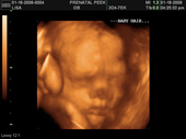 baby2007/2008-01-17_sonogram/BABY_8.JPG