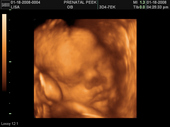 baby2007/2008-01-17_sonogram/BABY_9.JPG