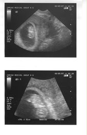 baby2007/ultrasounds/ultrasound.jpg