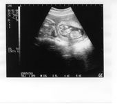 Tulia 12 week ultrasound